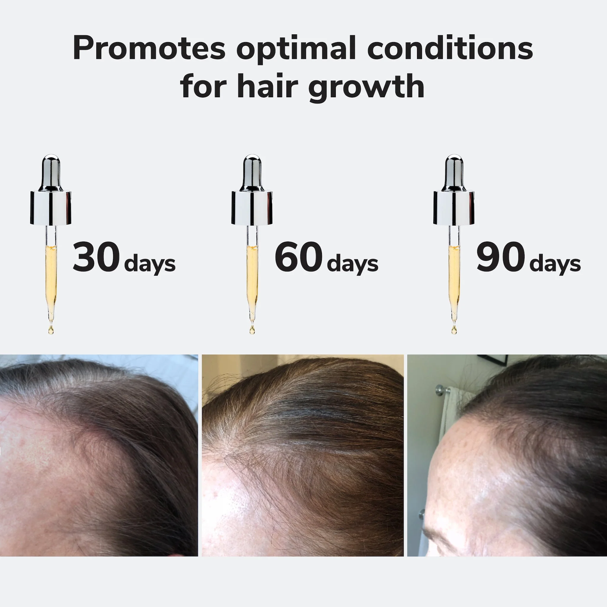 Youth Juice Scalp Treatment - Image 5